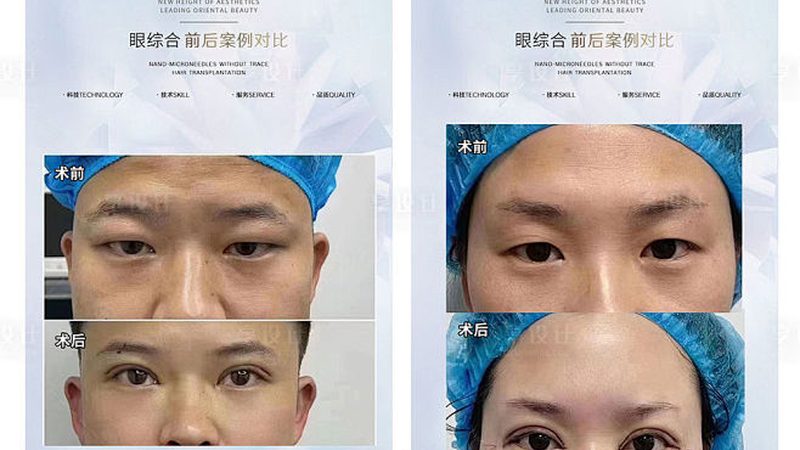 揭秘正规皮肤美容与整形美容医院排名的评判标准