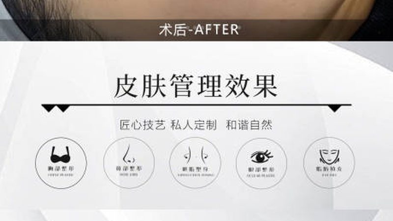 瘦脸操与瘦脸面膜：揭秘两者优缺点对比
