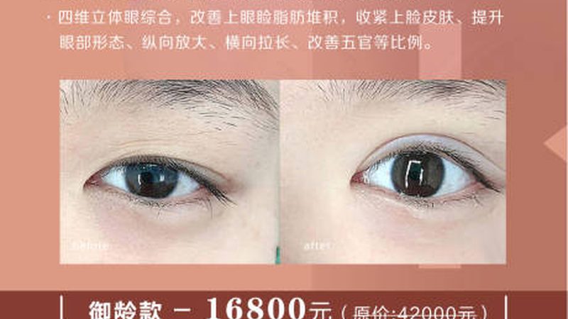 玻尿酸与自体脂肪填充泪沟：安全与自然的双重考量**