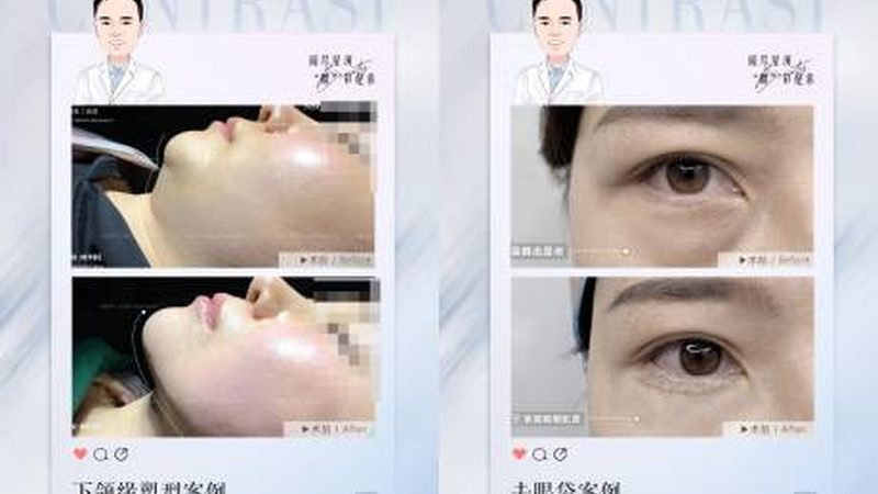 医疗美容加盟售后支持有哪些