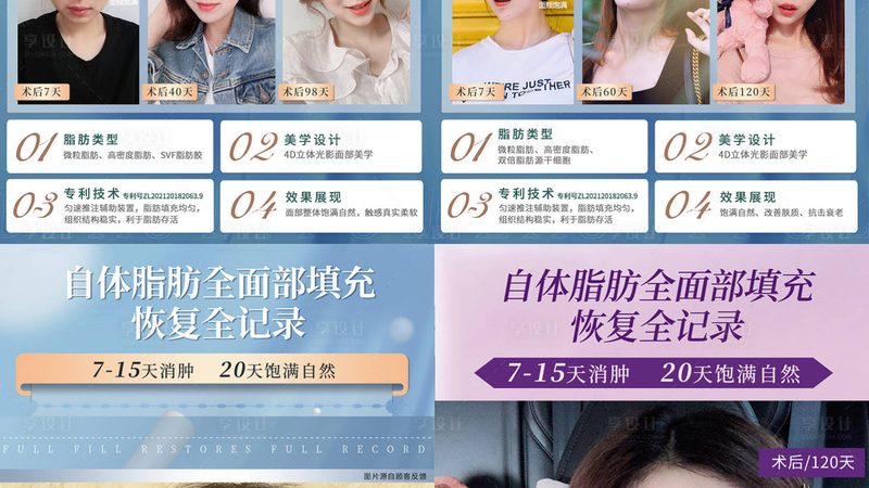 家用激光脱毛仪器：揭秘定制背后的技术奥秘