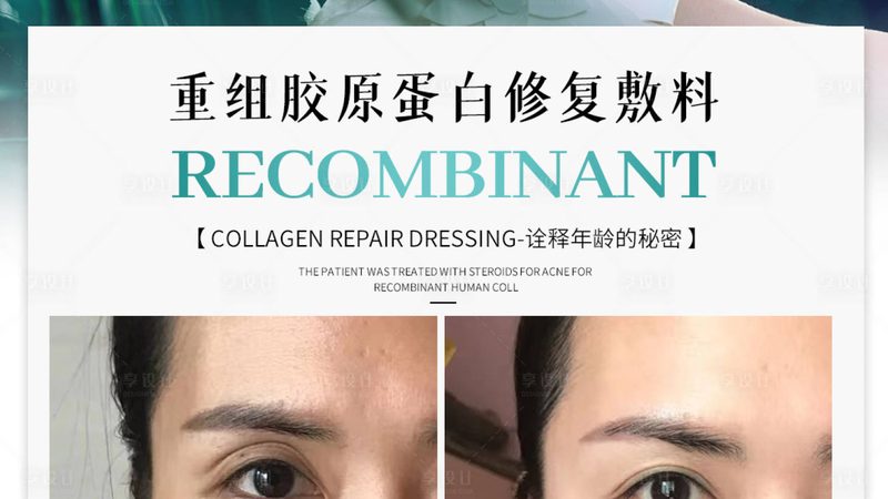 超声炮抗衰术后，这些注意事项你了解吗？**