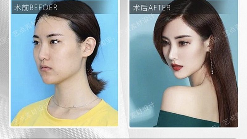 目前，市面上水光针品牌众多，以下列举了进口品牌排名前十的品牌：