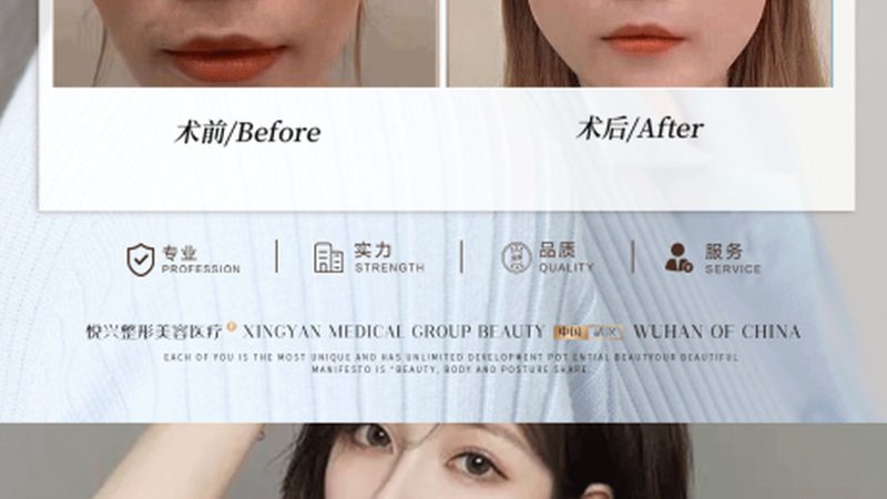 北京轻医美医院排名前十避坑指南