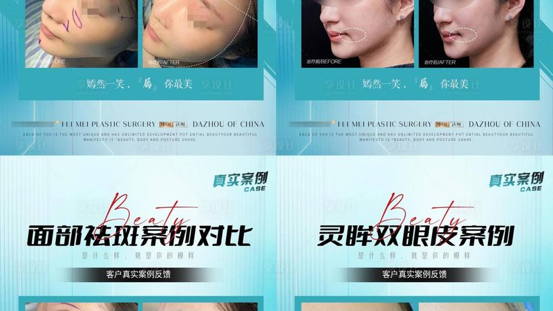 轻医美OEM定制：揭秘最小起订量的奥秘