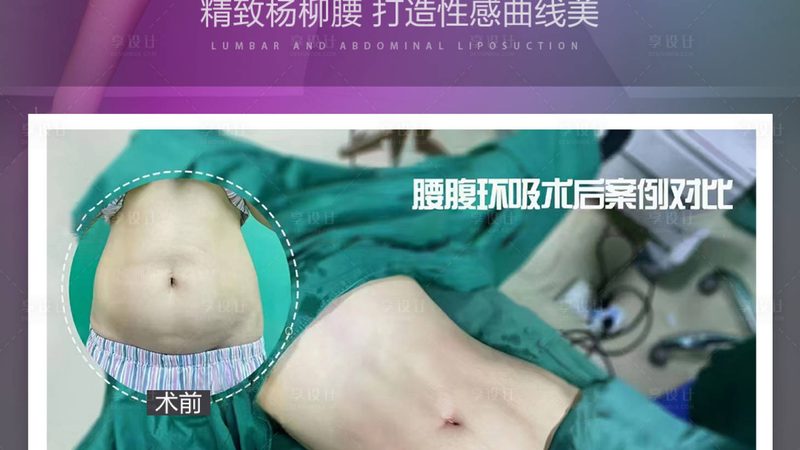 北京激光脱毛前后对比：揭秘真实效果与注意事项