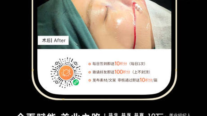 光子嫩肤祛痘印，术后护理攻略揭秘