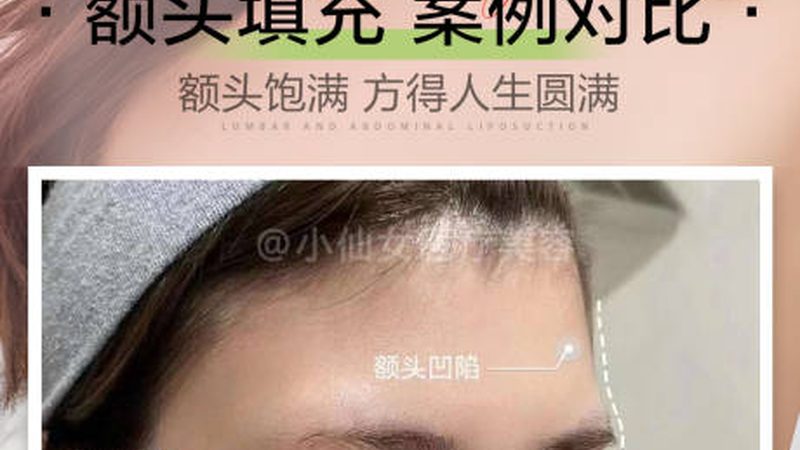 敏感肌管理：揭秘常见误区，科学护肤之道