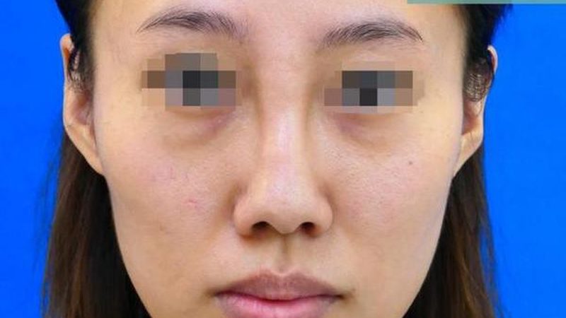 家用美容仪的价格主要由以下因素构成：